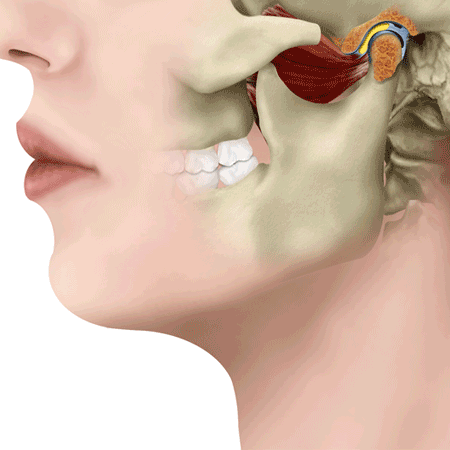 Normal Jaw | Park Place TMJ and Orofacial Pain | Face Pain Specialist In Stone Mountain, Georgia