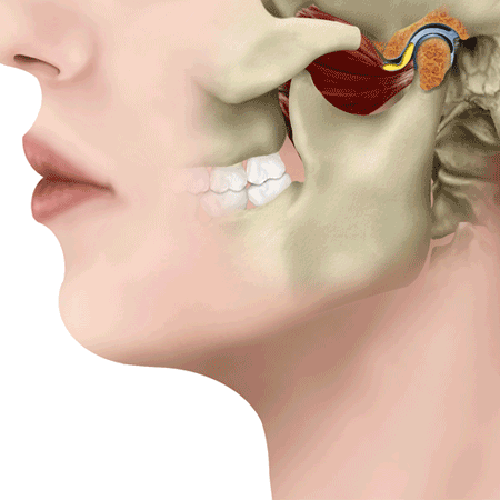 Popping Jaw | Park Place TMJ and Orofacial Pain | Face Pain Specialist In Stone Mountain, Georgia