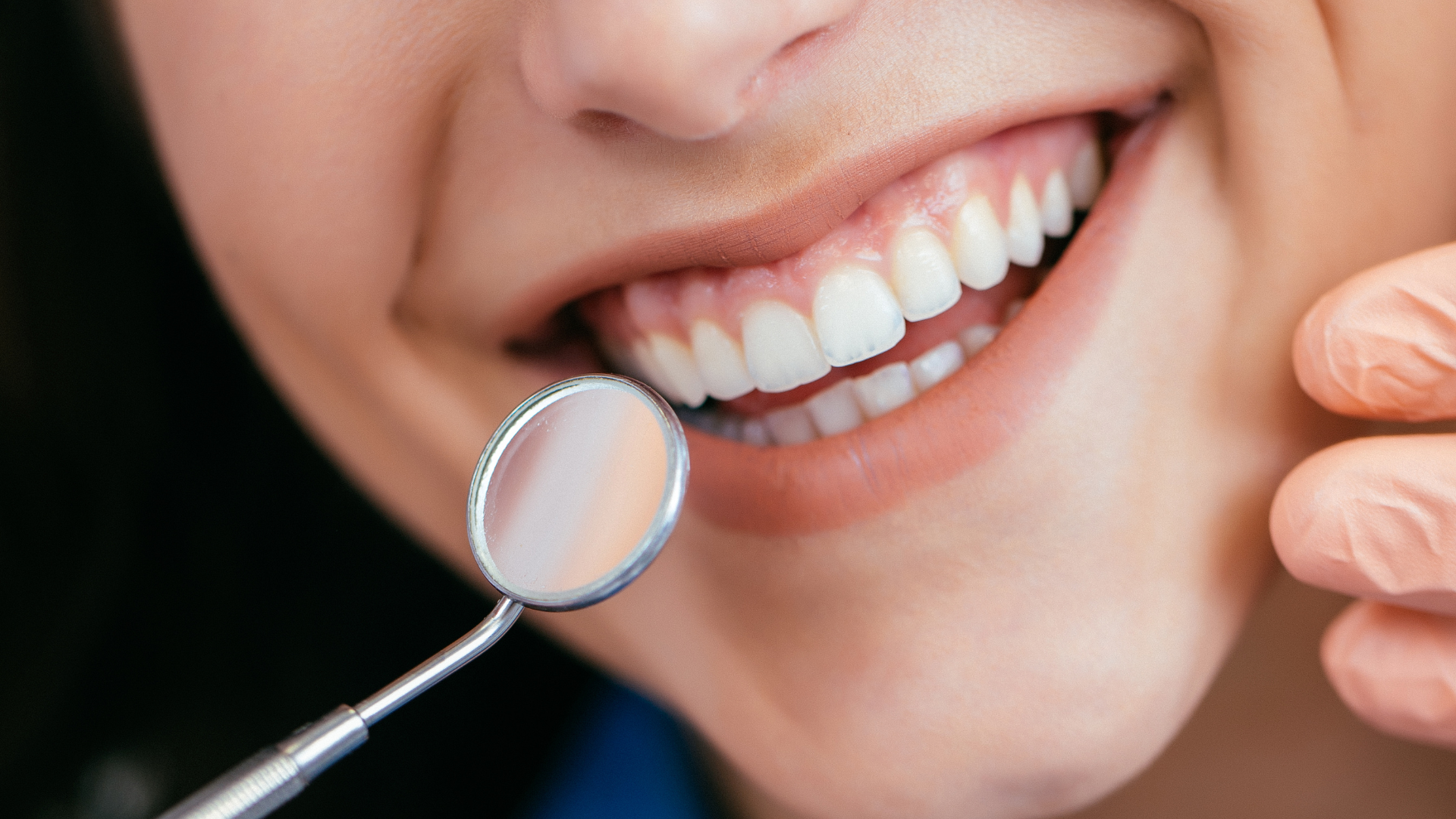 Close-up of a smiling mouth with a dental mirror inspecting clean white teeth