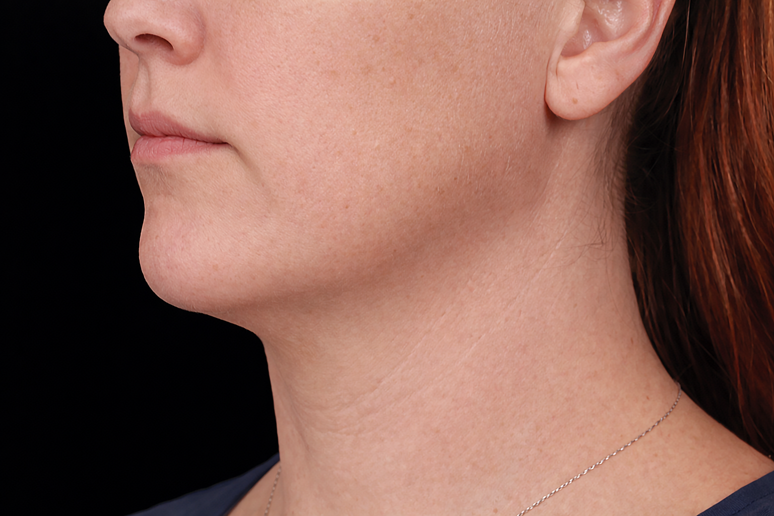 Side profile of a person’s lower face, neck, and ear against a black background