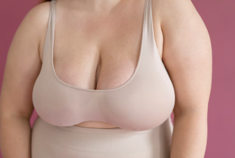 Quando é indicada a mamoplastia redutora em São Paulo