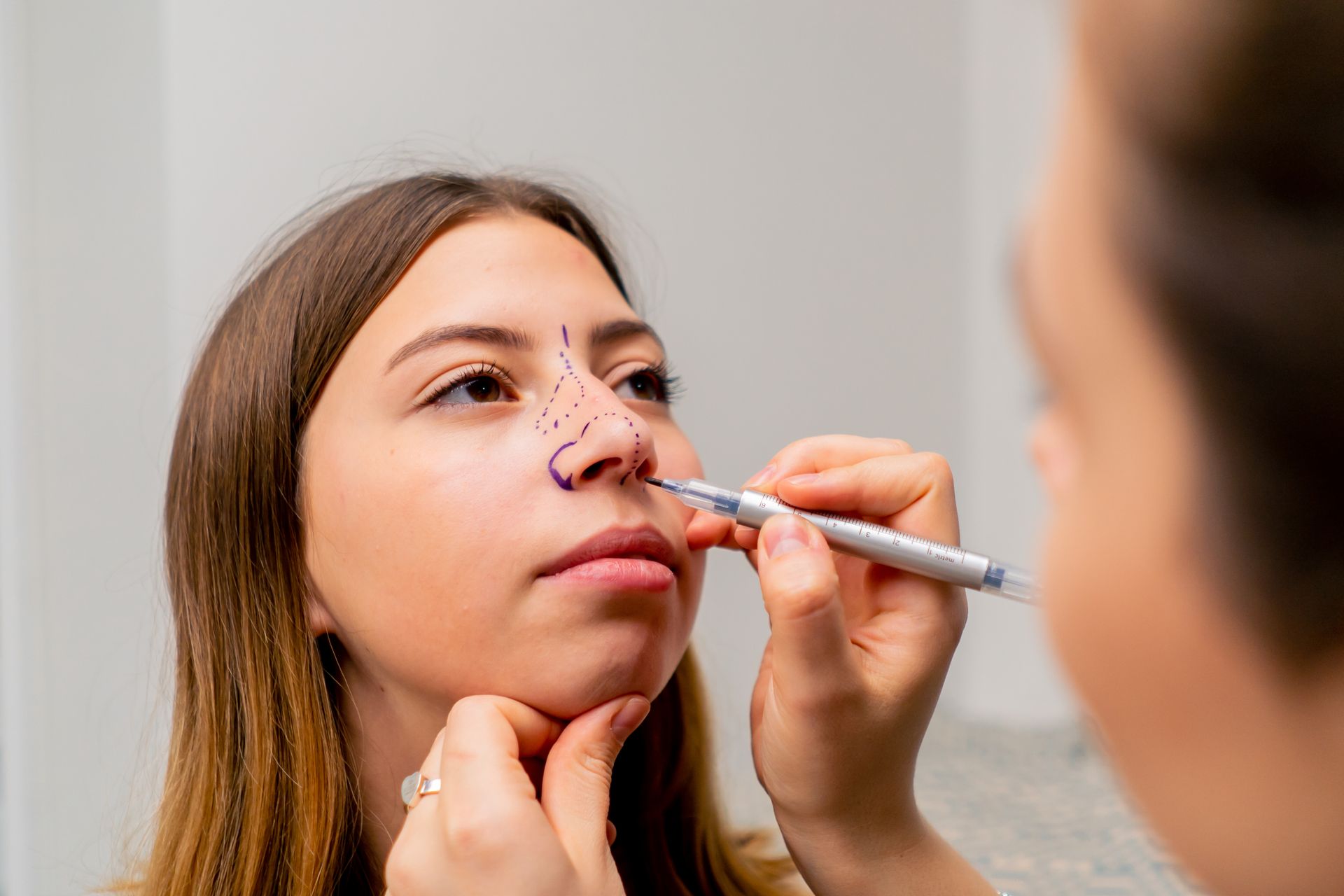 Rinoplastia corrige desvio de septo Rinoplastia corrige desvio de septo
