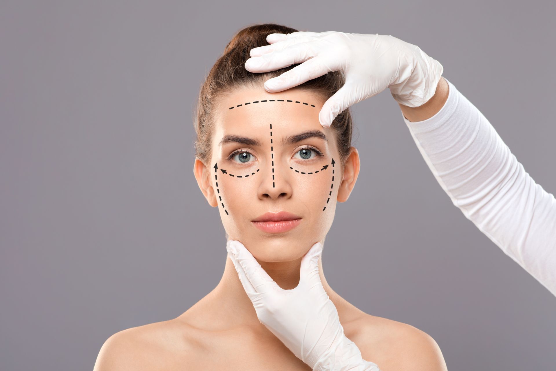 Rinoplastia estruturada ou preservadora qual a melhor técnica para cada caso