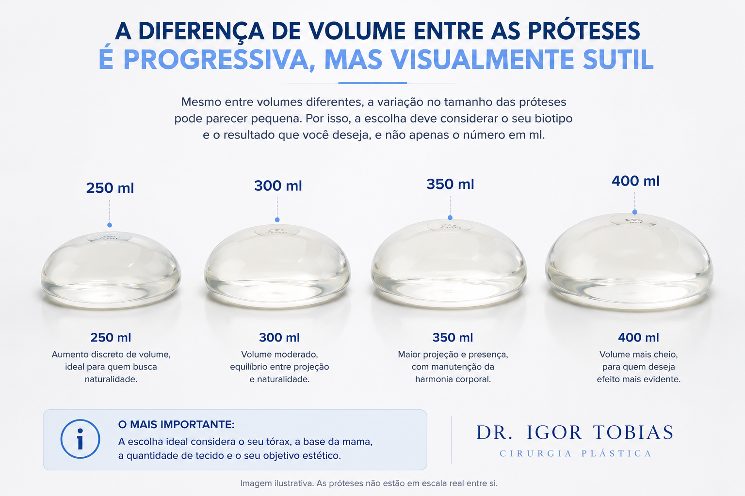 Comparação entre próteses de silicone de 250 ml, 300 ml, 350 ml e 400 ml.
