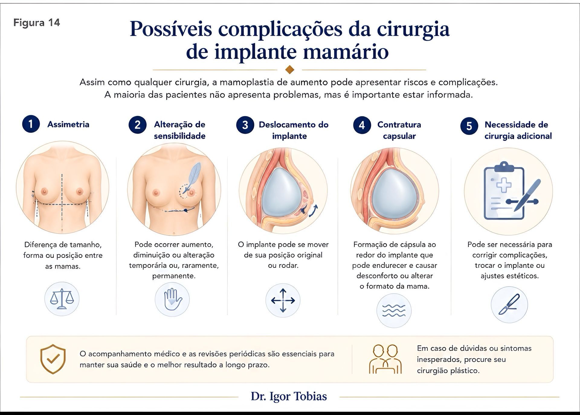 Possíveis complicações da cirurgia de prótese de silicone