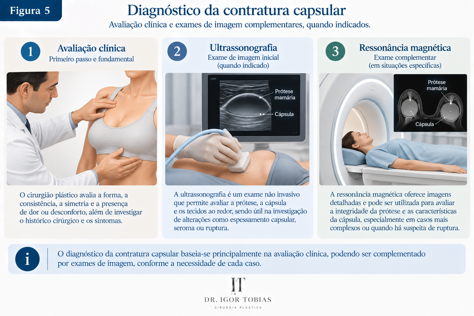 Avaliação clínica e exames de imagem utilizados na investigação da contratura capsular