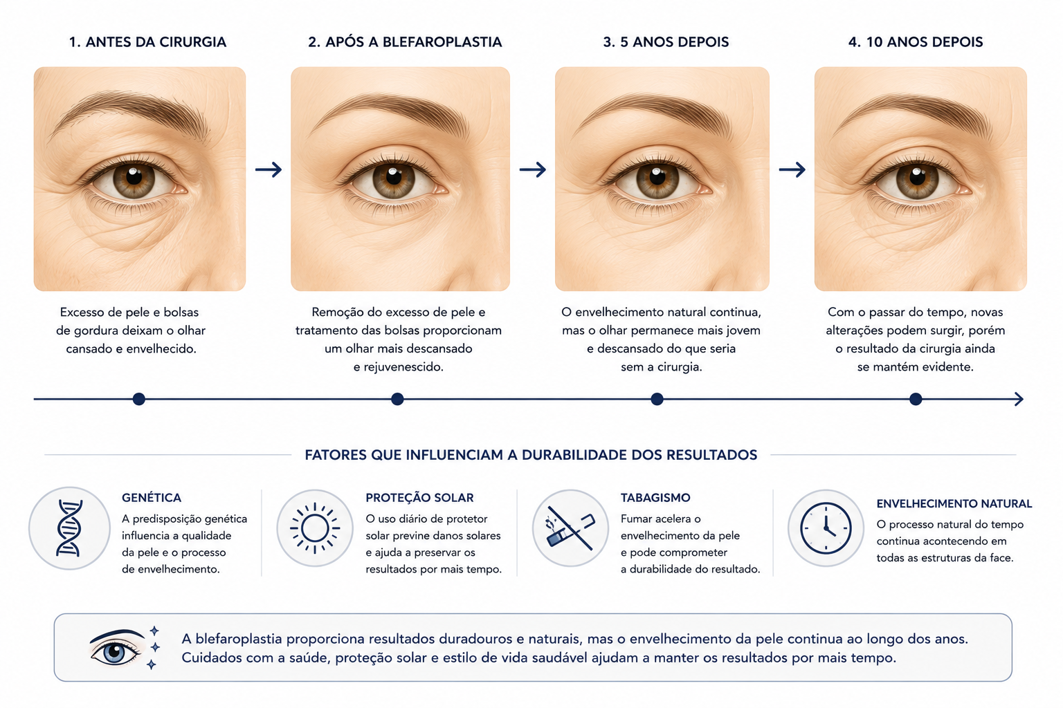 Linha do tempo mostrando a durabilidade dos resultados da blefaroplastia.