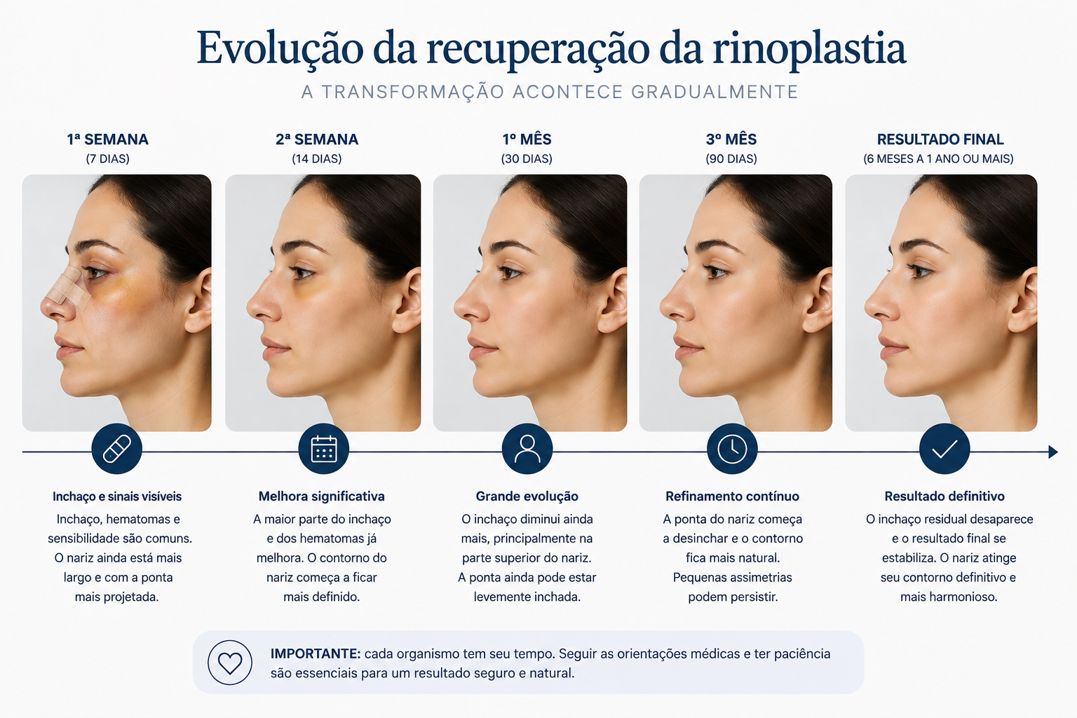 Linha do tempo mostrando a evolução visual da recuperação da rinoplastia na primeira semana, segunda semana, primeiro mês, terceiro mês e resultado final.