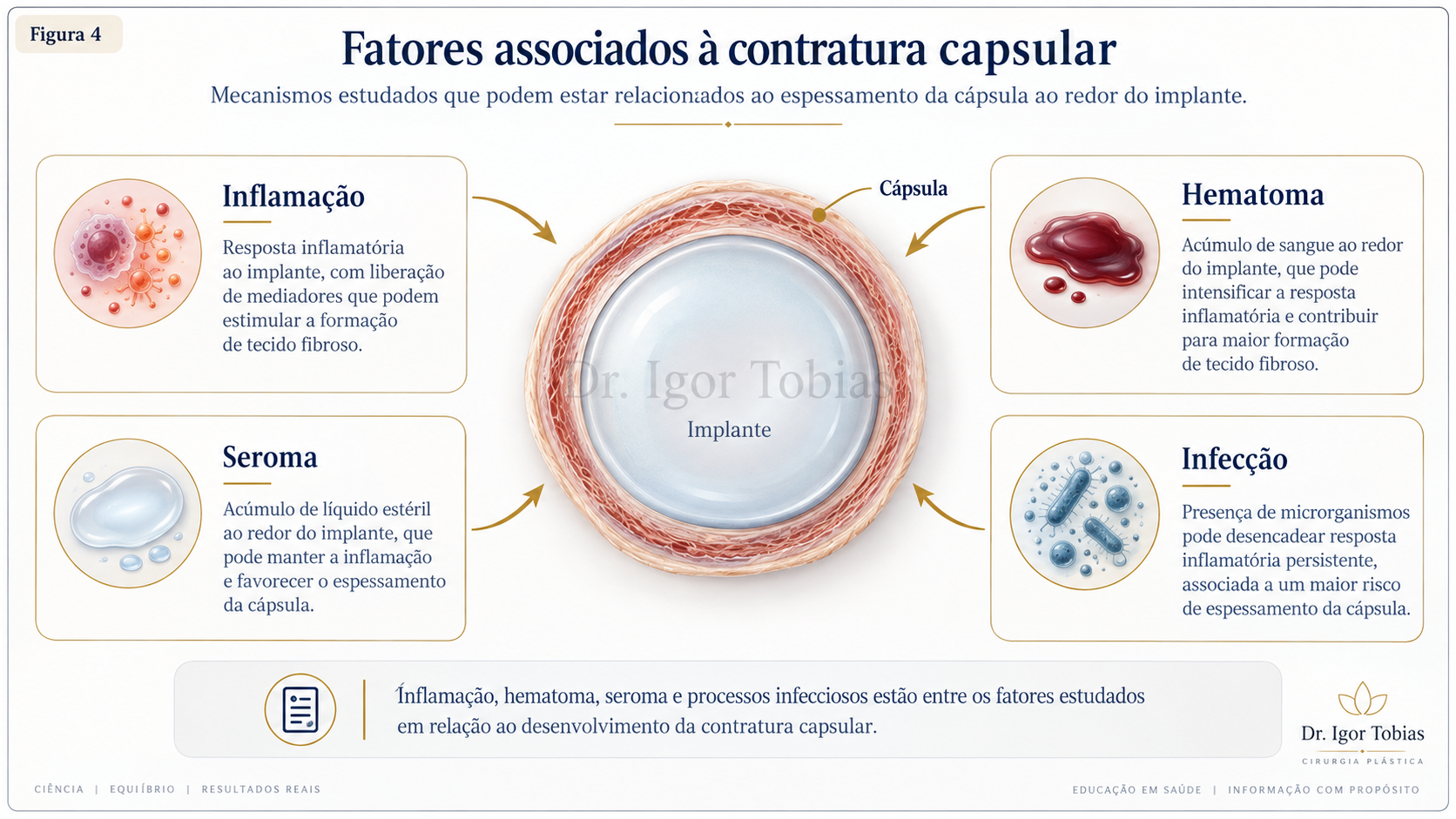 Fatores que podem estar associados ao desenvolvimento de contratura capsular em prótese mamária
