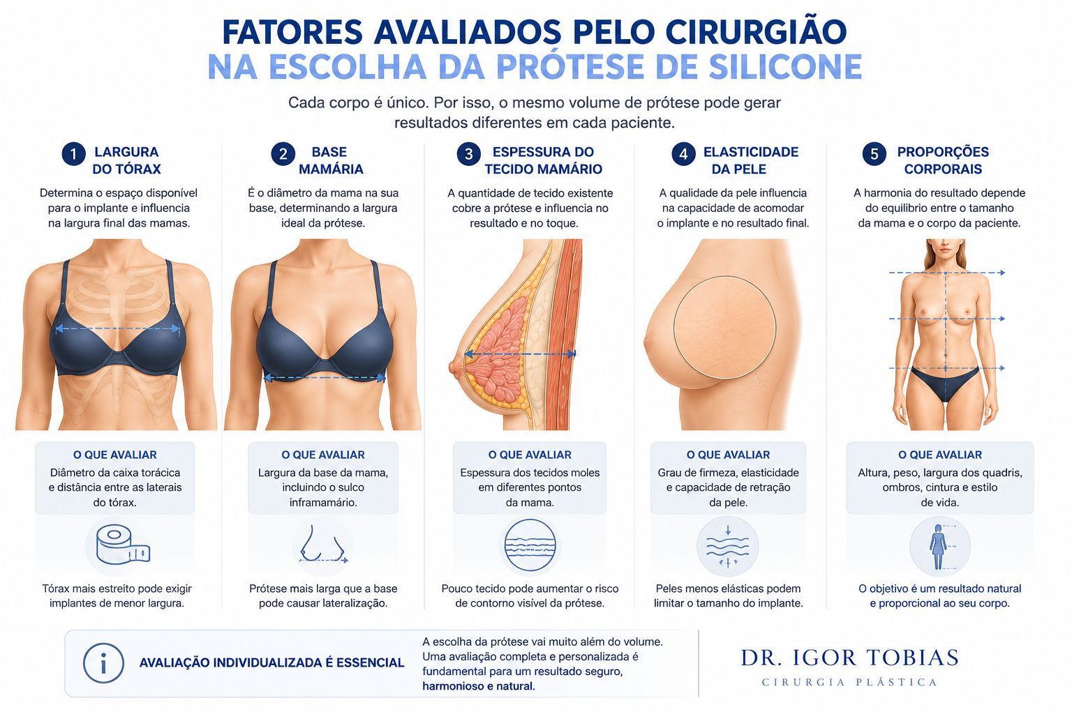 Fatores anatômicos utilizados para definir o tamanho ideal da prótese de silicone.
