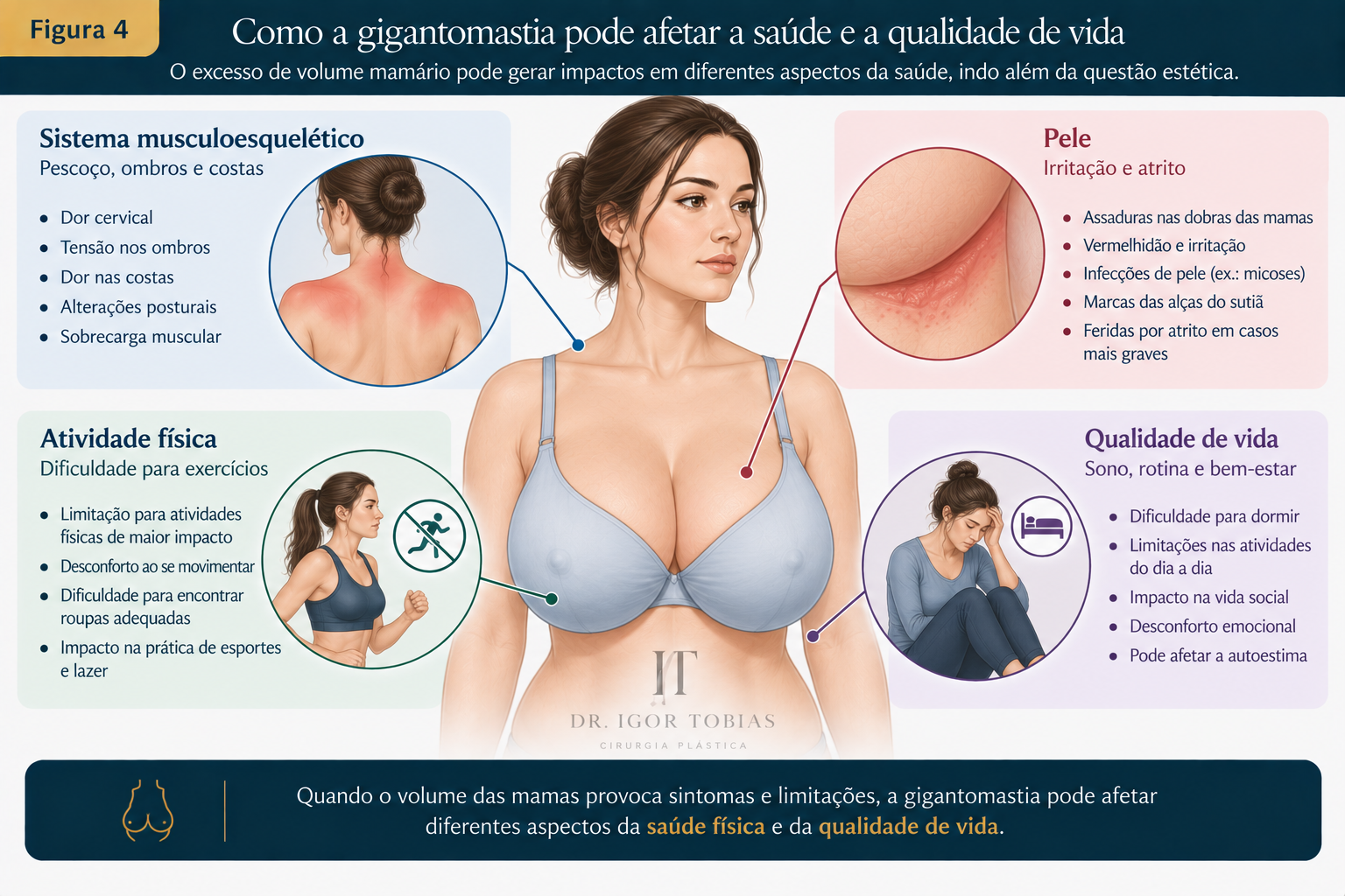 Infográfico mostrando os possíveis impactos da gigantomastia na saúde, incluindo dor musculoesquelética, alterações na pele, dificuldade para exercícios e prejuízo da qualidade de vida.