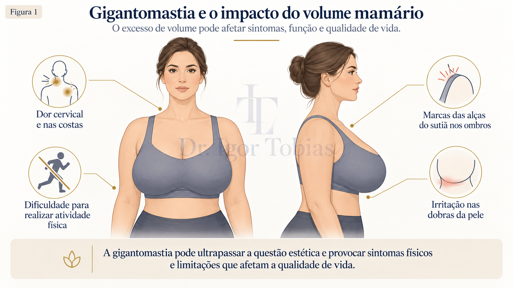 Ilustração médica mostrando como a gigantomastia e o grande volume das mamas podem causar dor, marcas nos ombros, alterações na pele e limitações físicas.
