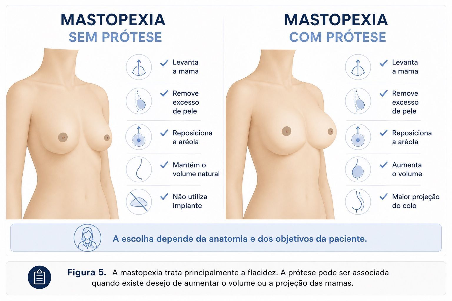 Infográfico comparando mastopexia sem prótese e mastopexia com prótese de silicone.