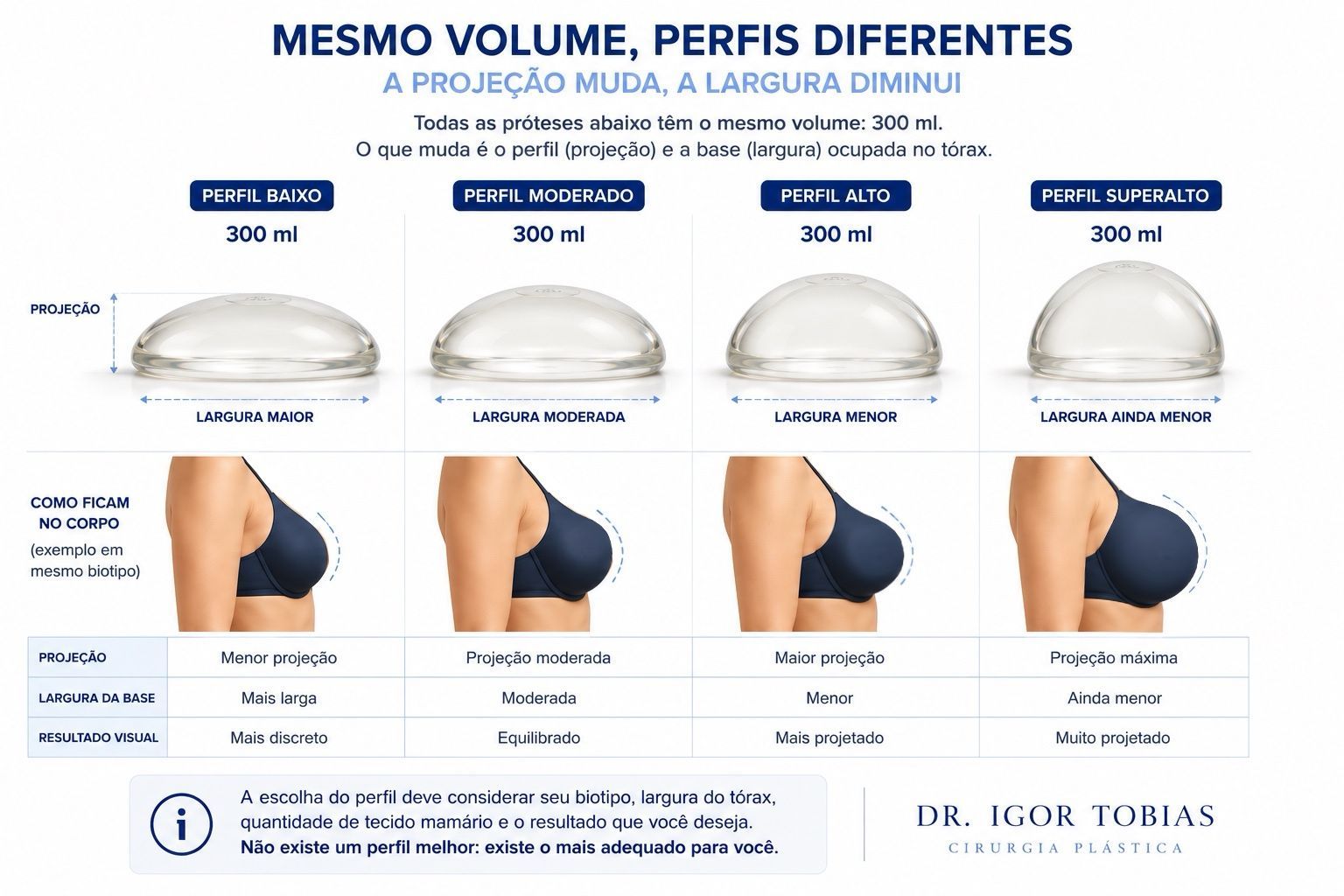 Comparação entre próteses de silicone de mesmo volume e perfis diferentes.
