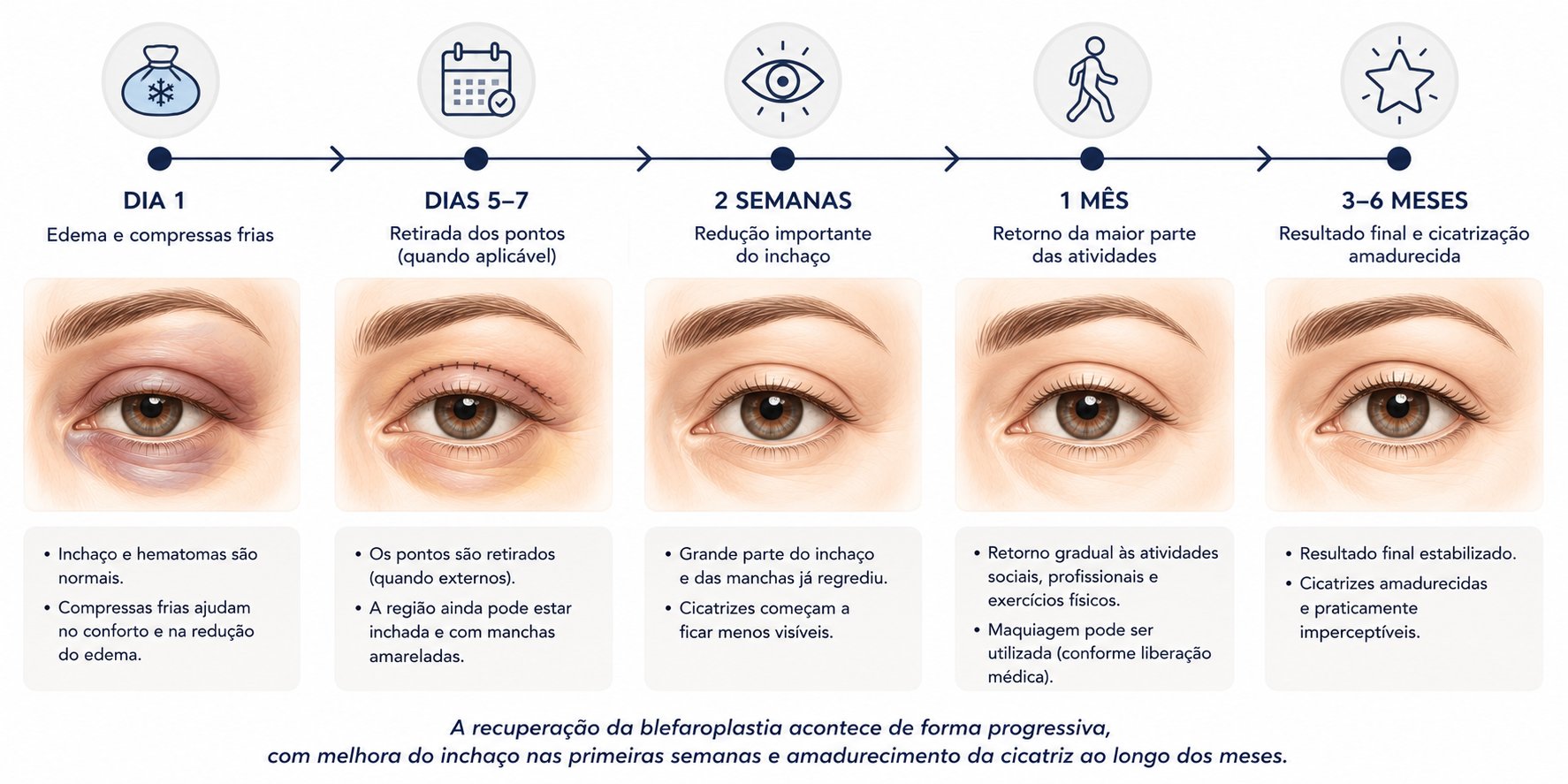Linha do tempo ilustrando as principais fases da recuperação da blefaroplastia.