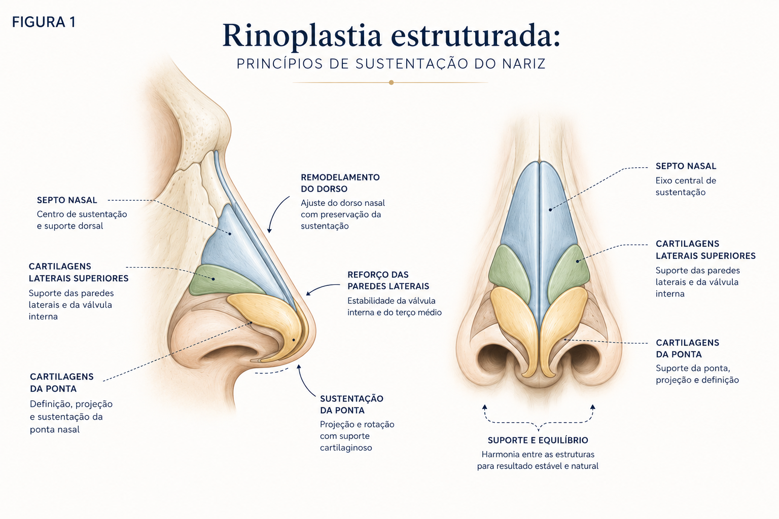 Ilustração dos principais elementos de sustentação considerados na rinoplastia estruturada.