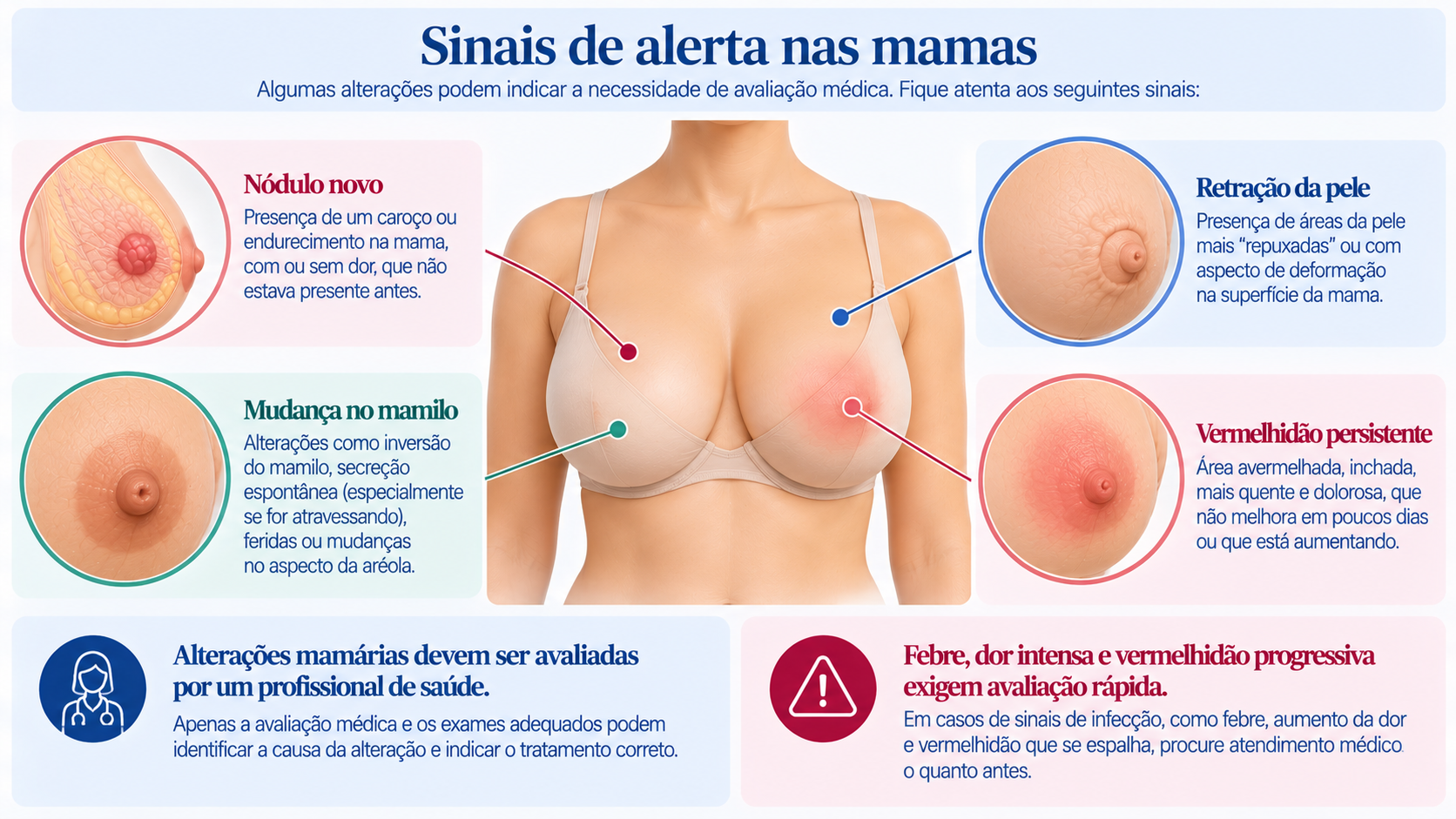 Infográfico com sinais de alerta nas mamas, incluindo nódulo novo, retração da pele, mudança no mamilo e vermelhidão persistente.