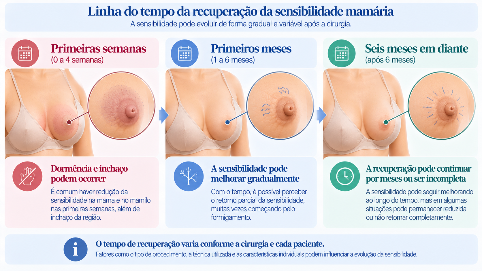 Linha do tempo educativa mostrando a evolução possível da sensibilidade mamária nas primeiras semanas, nos primeiros meses e após seis meses de uma cirurgia.