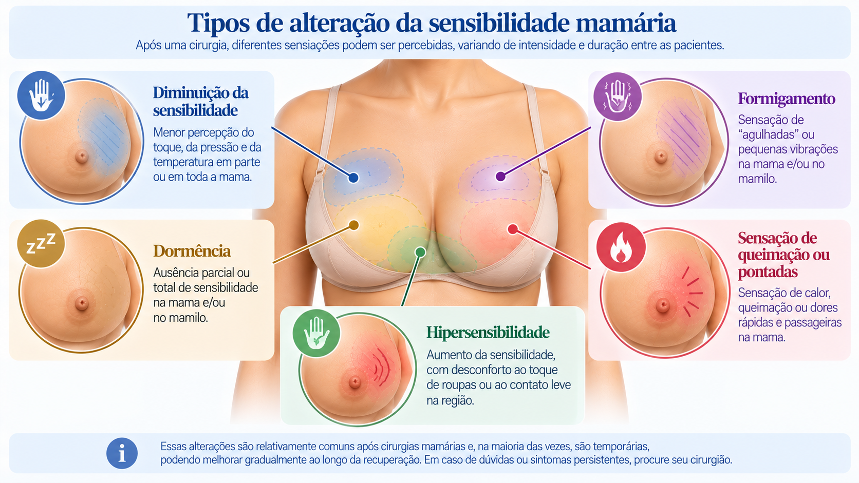 Infográfico com os principais tipos de alteração da sensibilidade mamária após cirurgia, incluindo dormência, formigamento, hipersensibilidade e redução da percepção do toque.