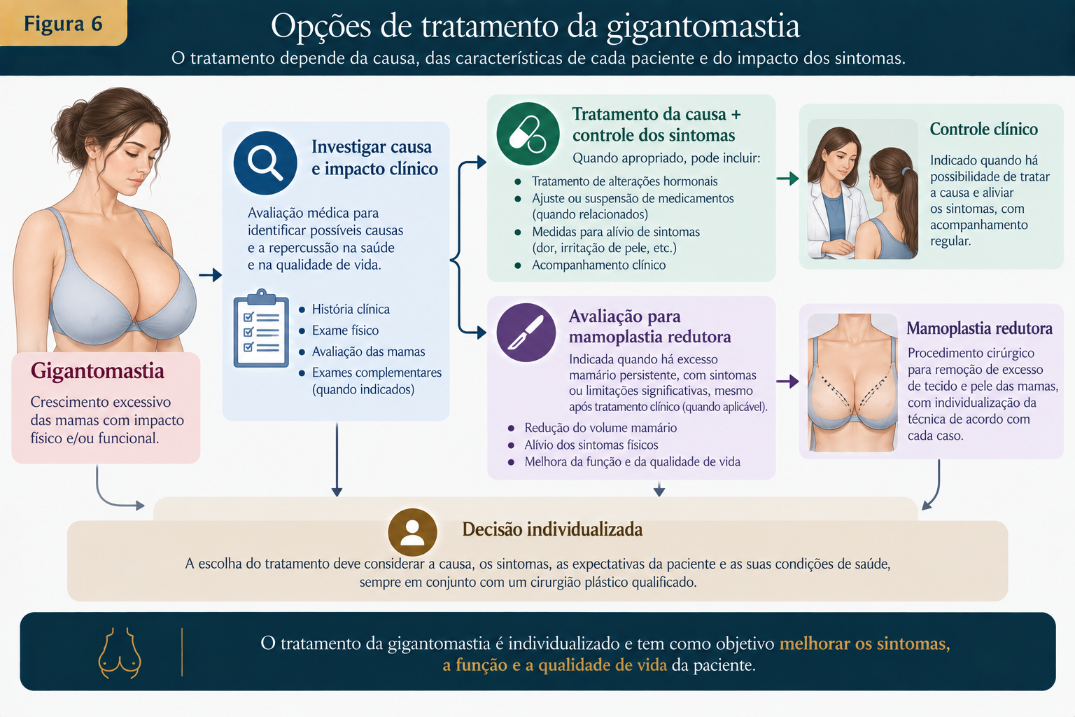 Fluxograma médico mostrando as opções de tratamento da gigantomastia, incluindo controle da causa, medidas para aliviar sintomas e avaliação para mamoplastia redutora.