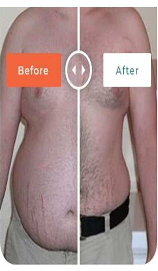 Before-and-after torso comparison showing reduced abdominal fat and a flatter waistline.