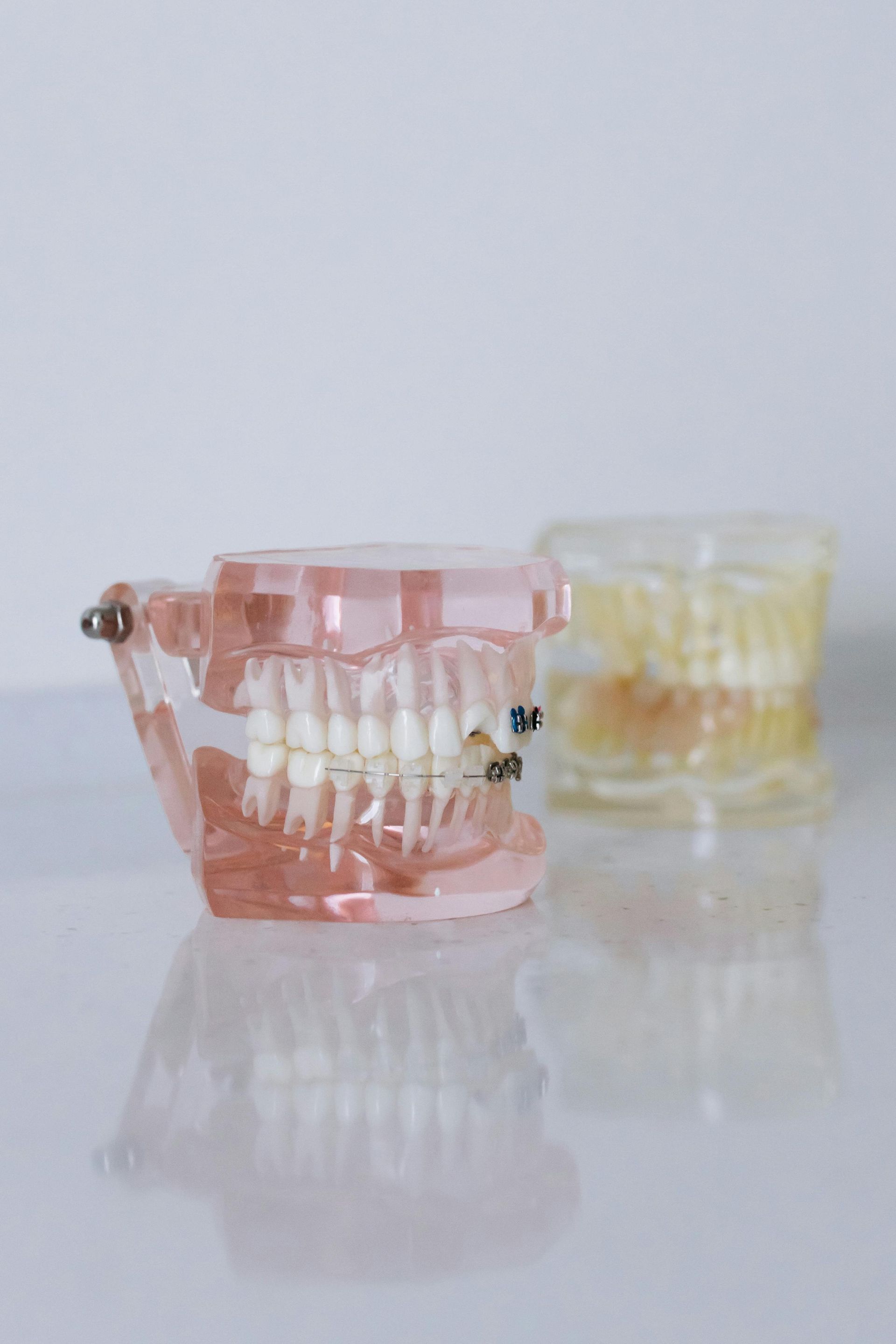 Two clear, plastic dental models of jaws are set on a white reflective surface, one pink and one yellow.