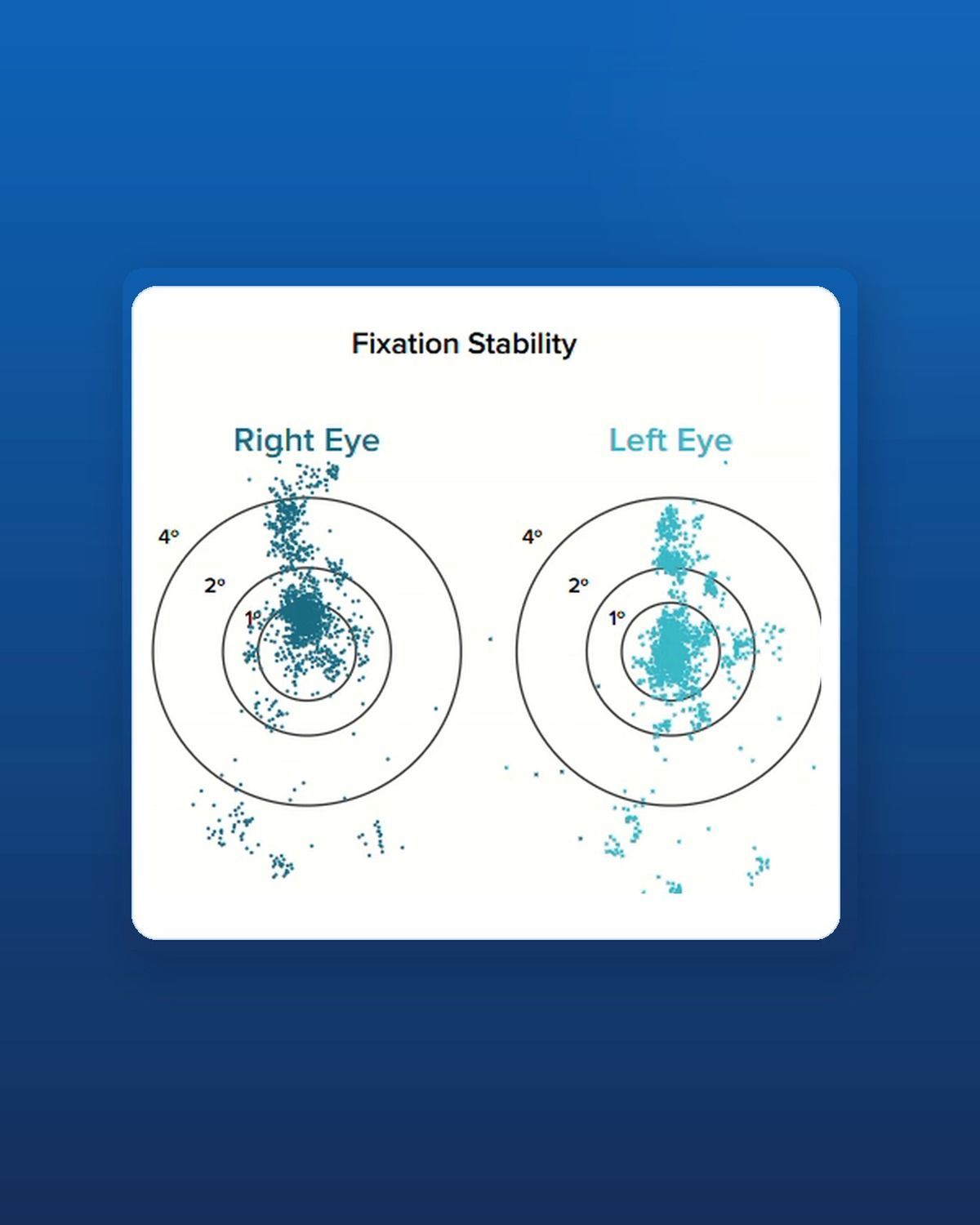 Fixation stability results from a RightEye Dynamic Vision Assessment at BodyLink Silverdale