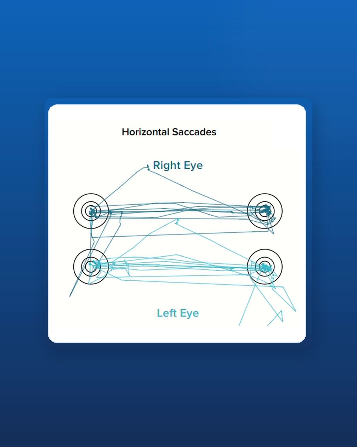 Horizontal saccades trace from a RightEye Dynamic Vision Assessment at BodyLink Silverdale