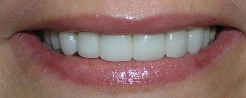 Close-up of smiling mouth with shiny pink lipstick and bright white teeth.
