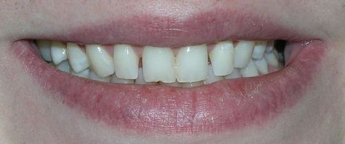 Close-up of a smiling mouth with visible teeth and full lips.