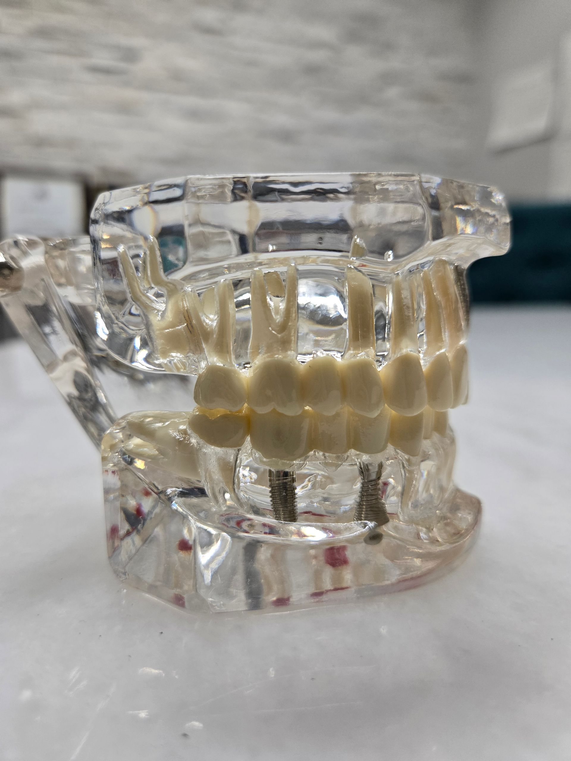A close up of a dental model on a table.