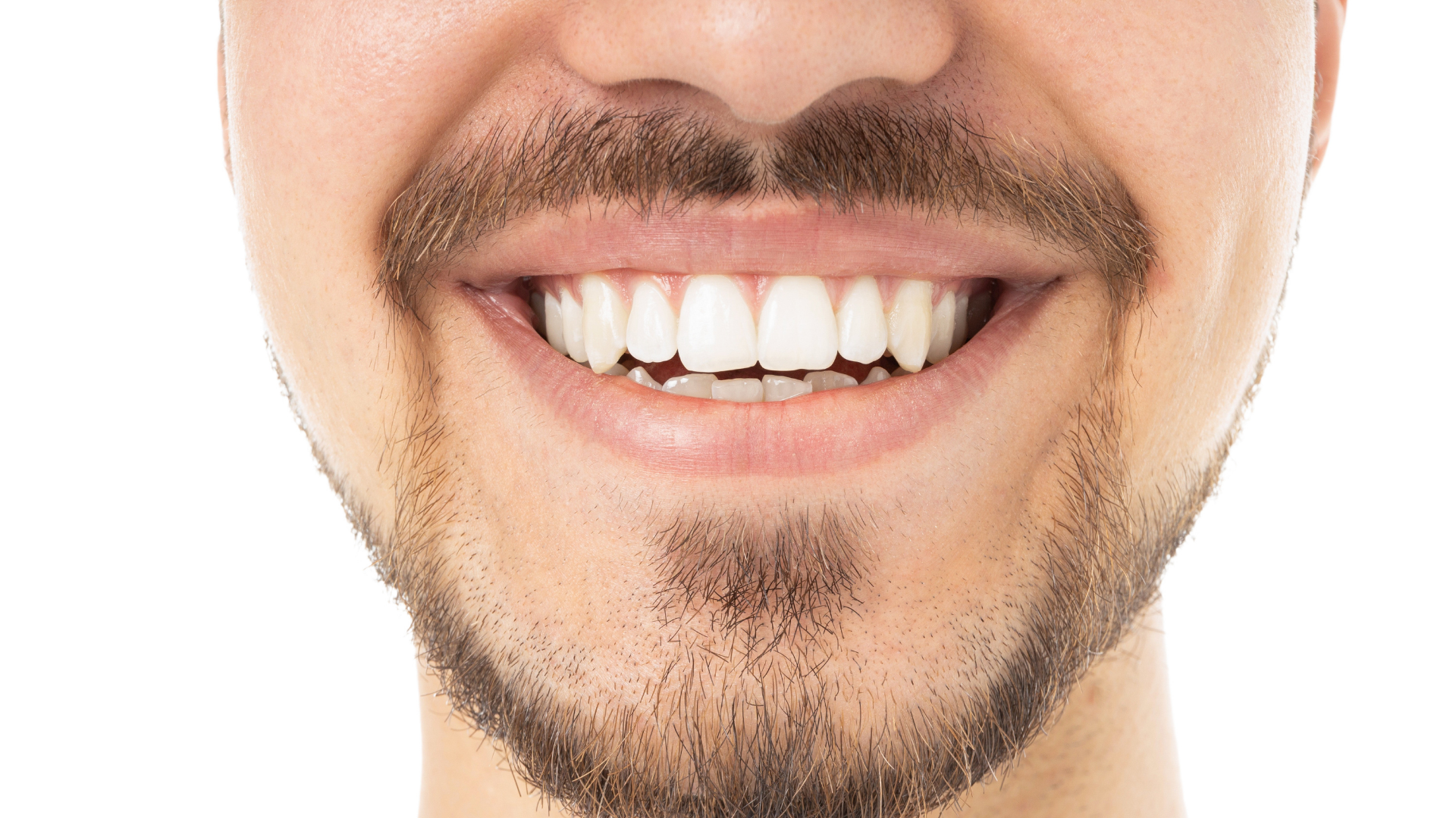 Close-up of a smiling mouth with a mustache and goatee showing white teeth