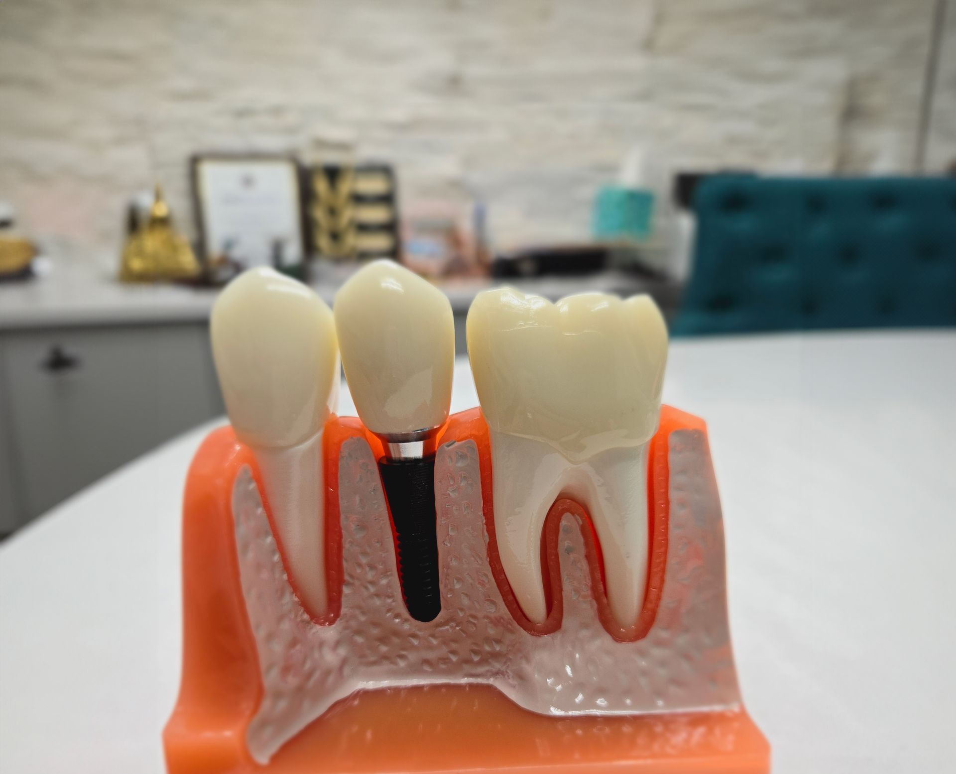 A model of a dental implant between two teeth on a table.