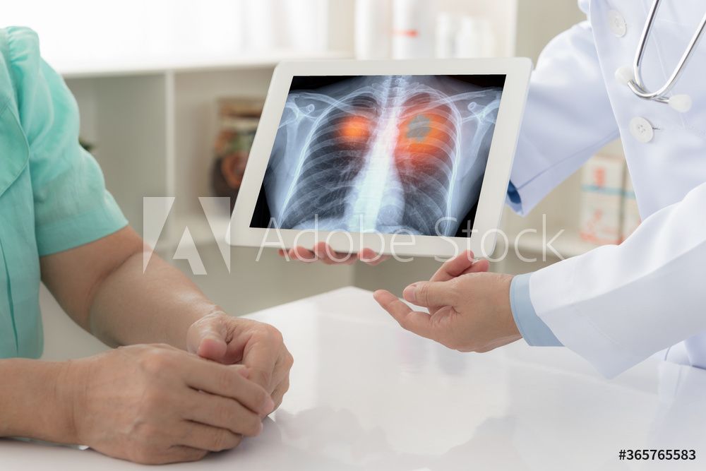 AdobeStock_365765583_Preview A doctor is showing a patient an x-ray of their lungs on a tablet.