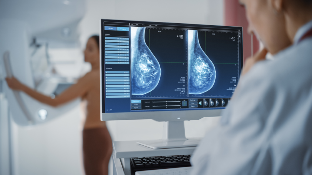 A doctor is looking at a breast scan on a computer screen.