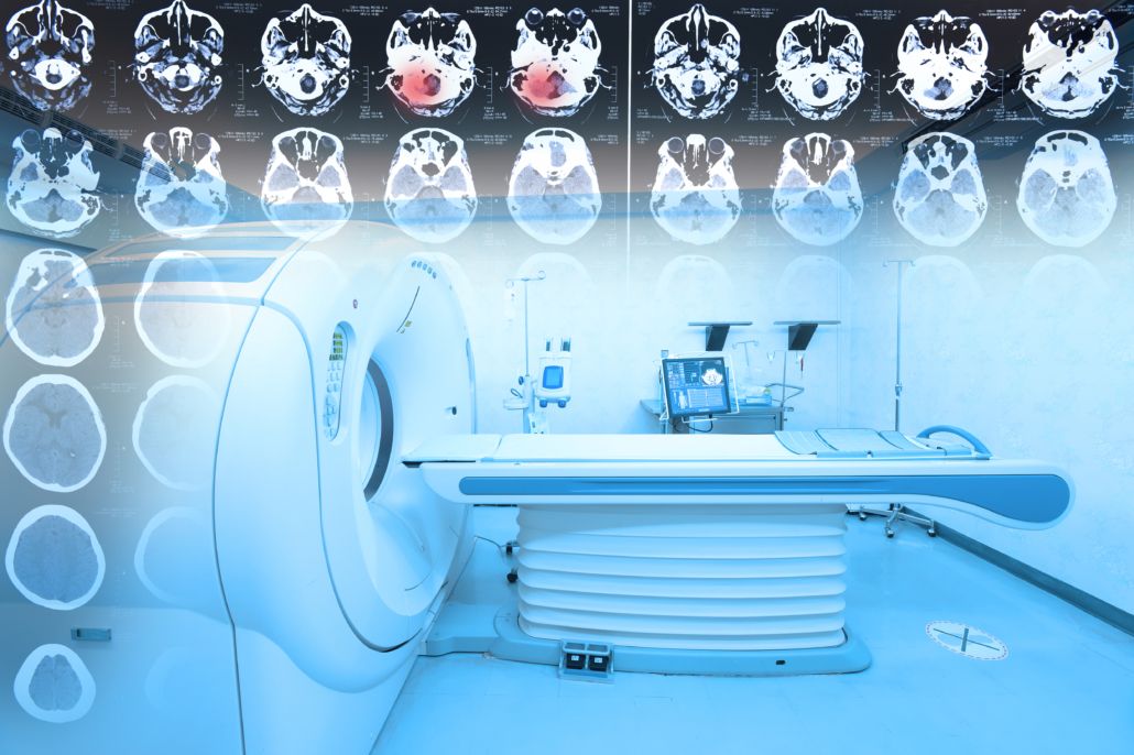 Mri,Scanner,Room,With,Images,From,A,Computerized,Tomography,Of A ct scan of a person 's brain in a hospital room.