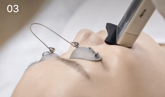 Pain-managed lifting treatment