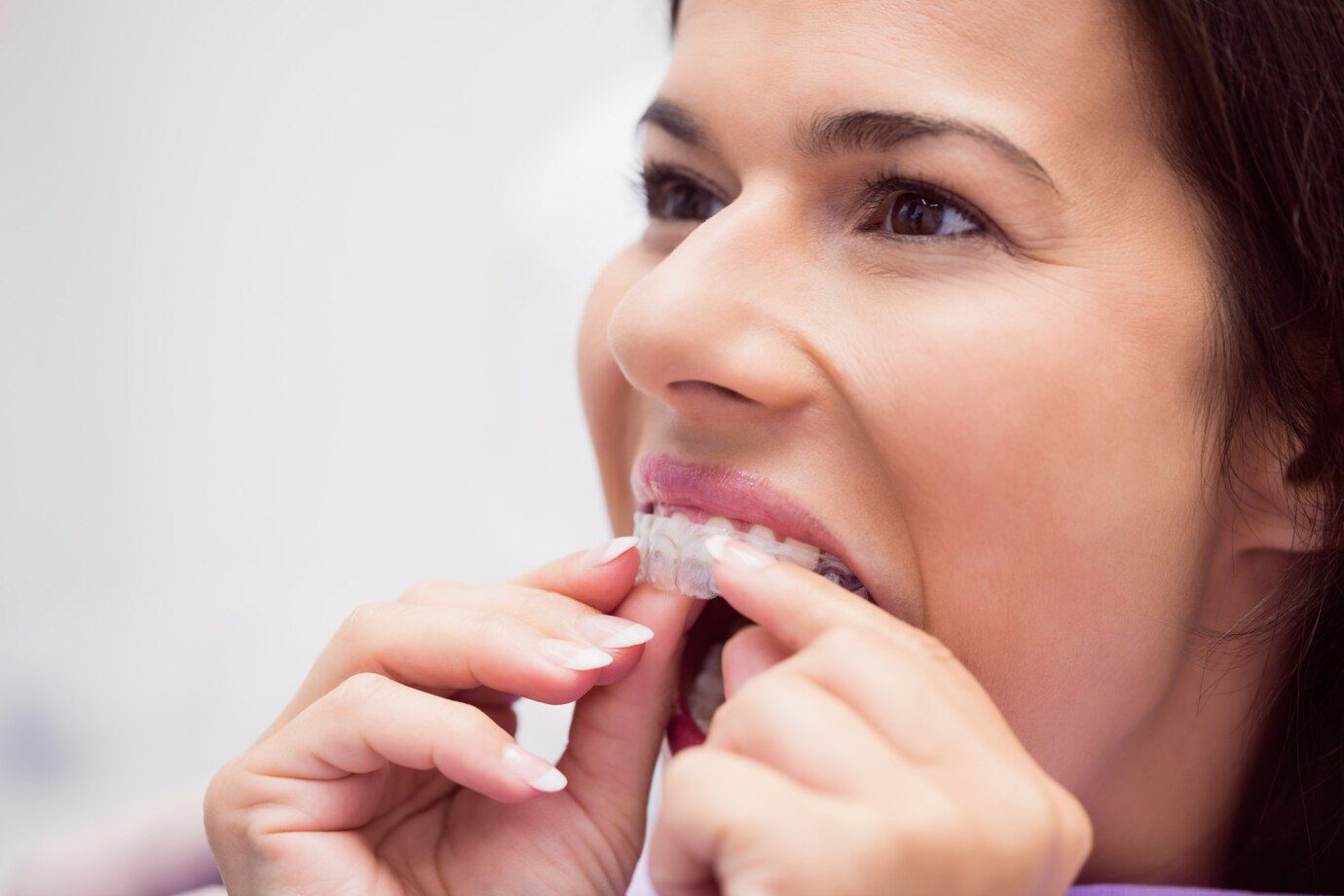 Aligners