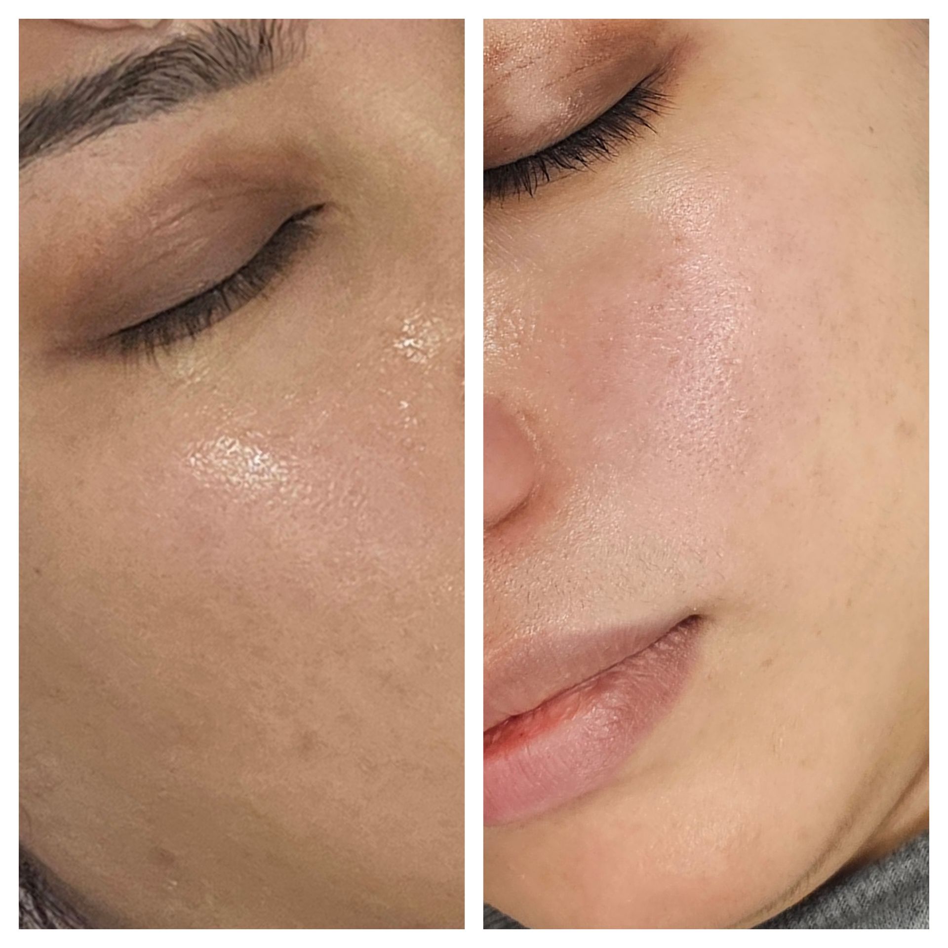 A before and after photo of a woman 's face with her eyes closed.