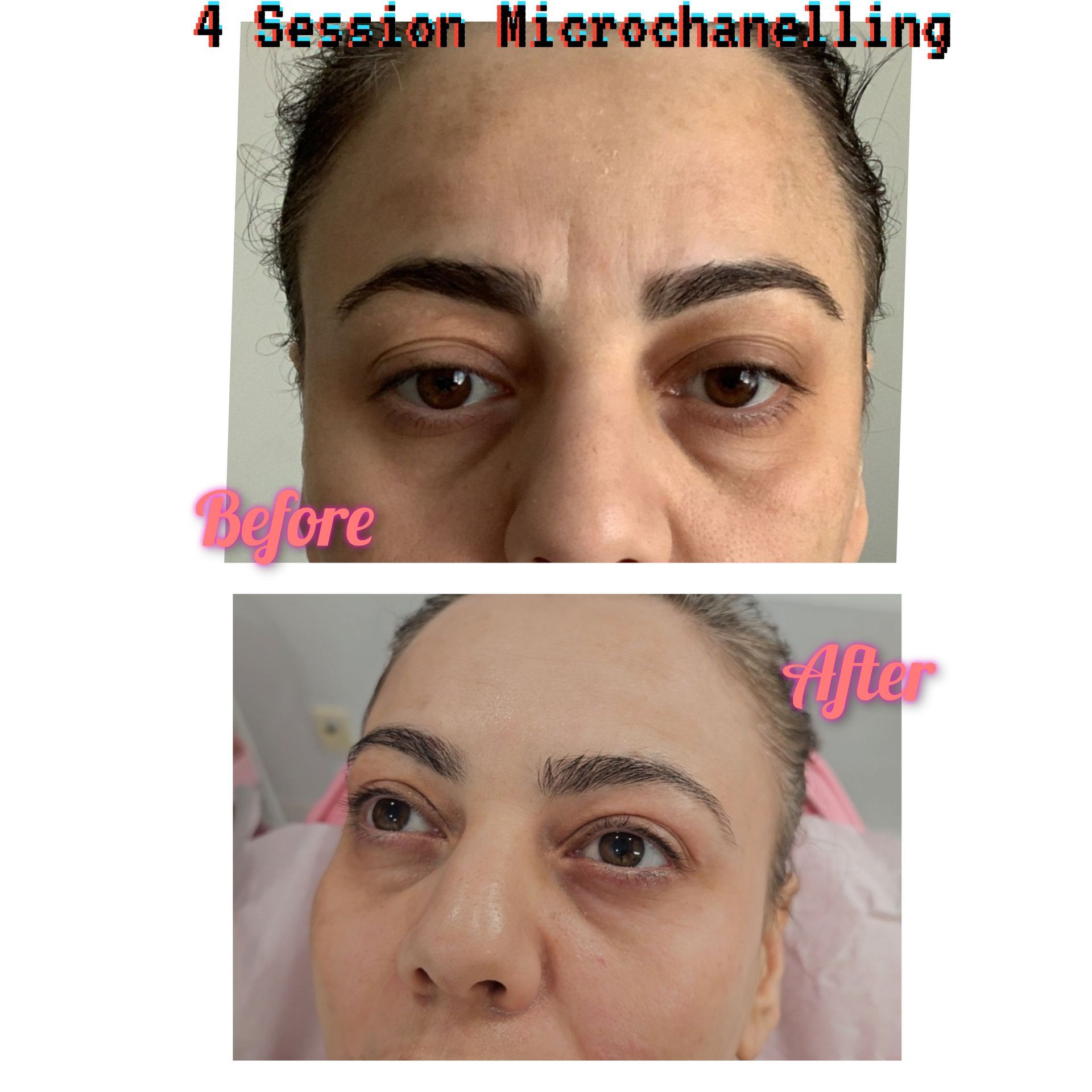 A before and after photo of a woman 's face
