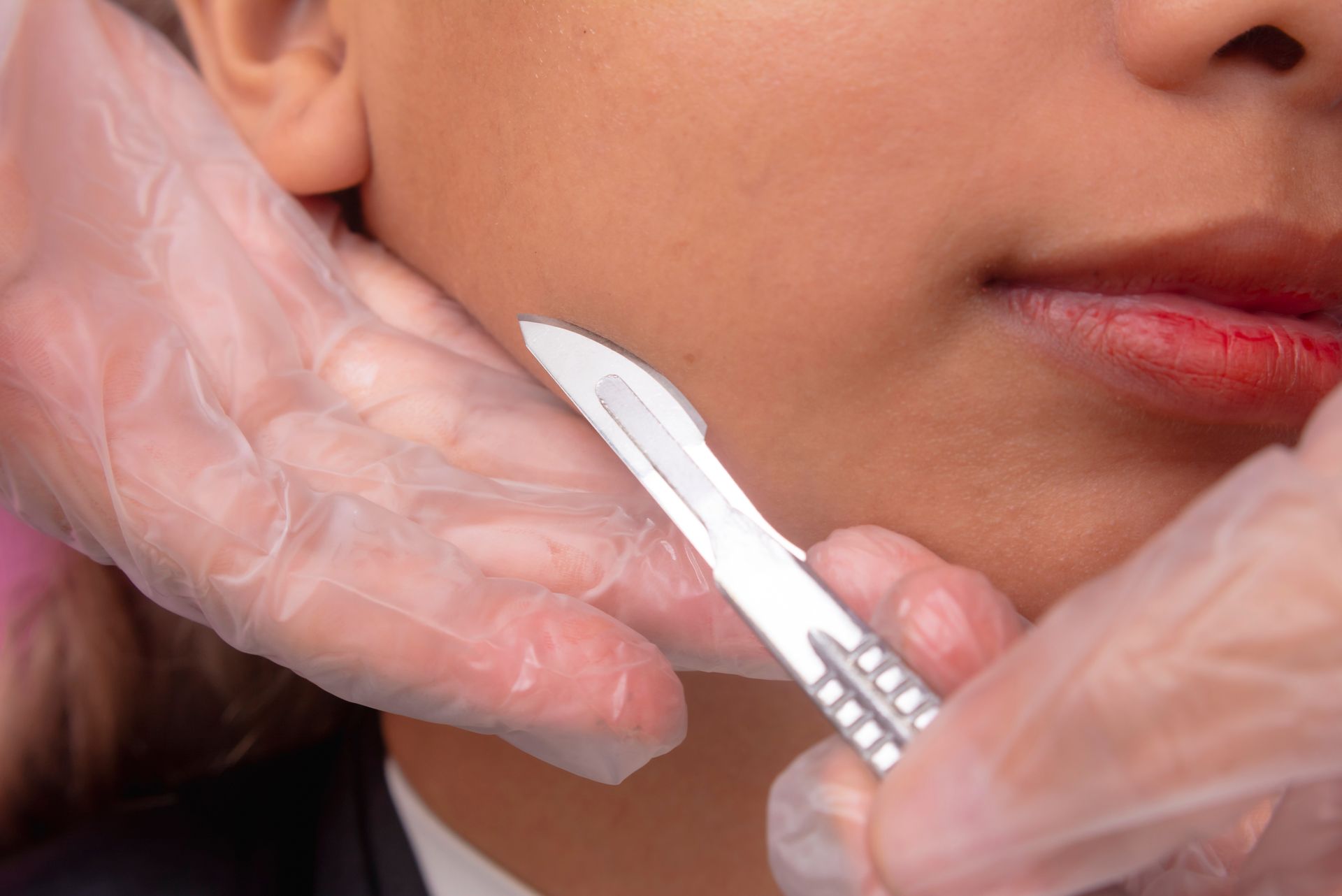 Person's cheek being held by gloved hands, with a scalpel poised nearby, suggesting a medical procedure.