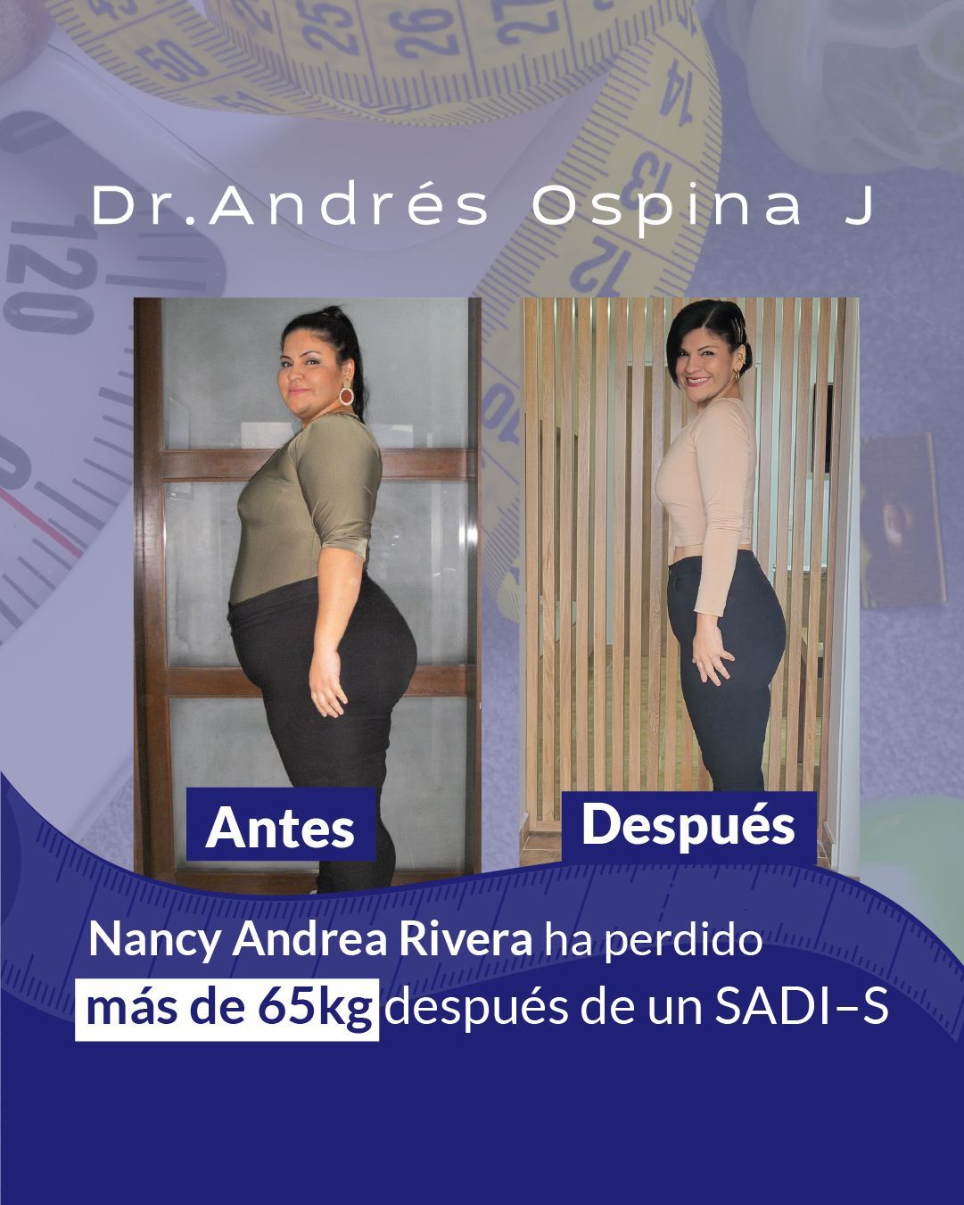 Una foto de antes y después de Nancy Andrea Rivera.