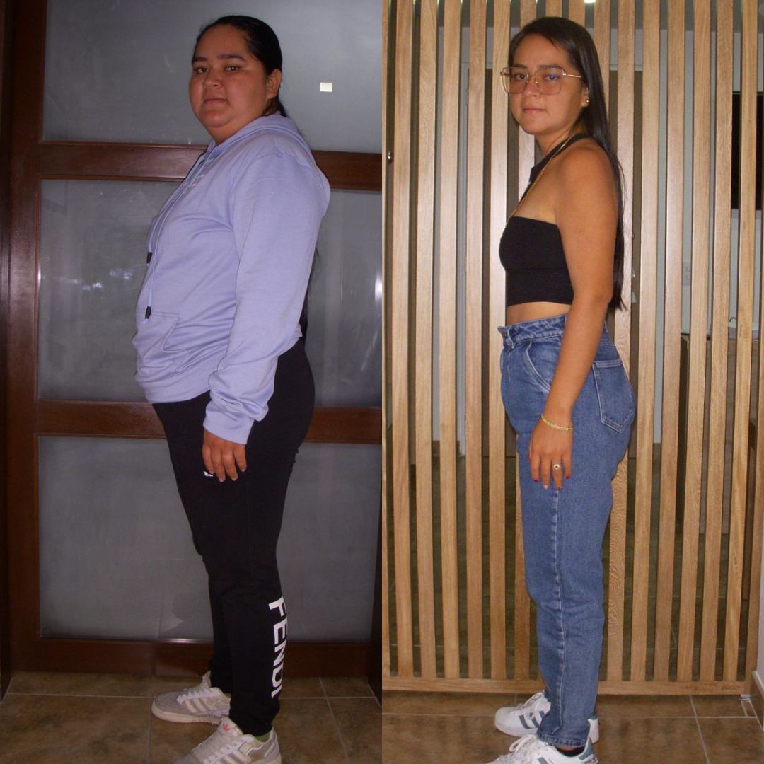 Cirugía bariátrica en Bogotá