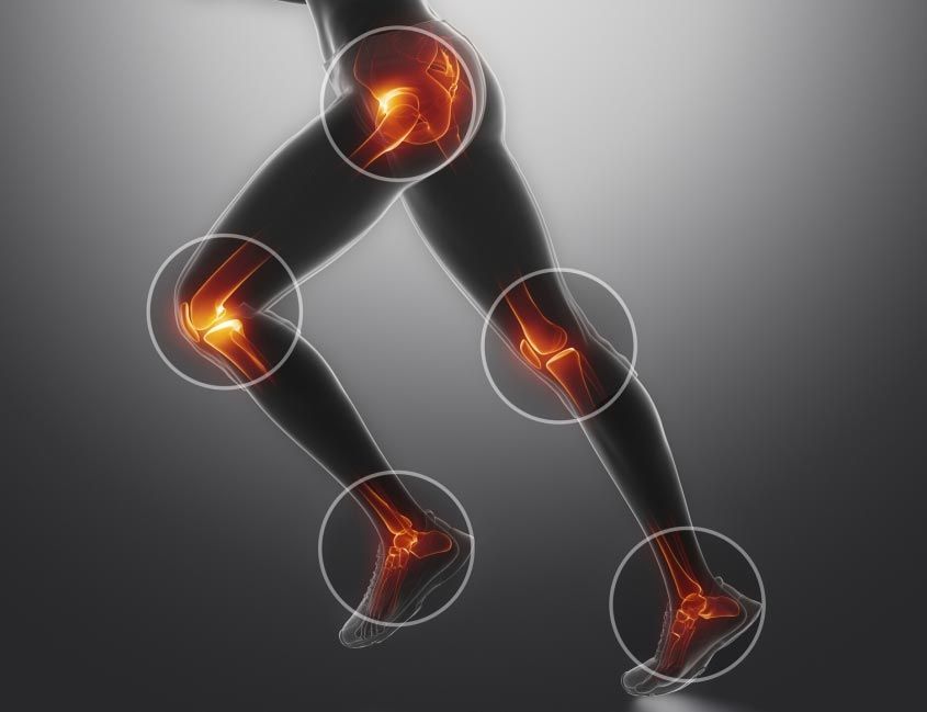 Bursitis inflammation affecting joints and surrounding tissue diagram