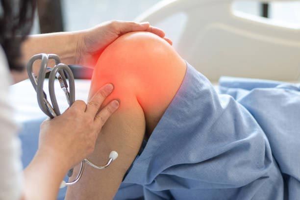 Physiotherapy treatment for knee bursitis pain relief at Dynamic Physiotherapy Mississauga