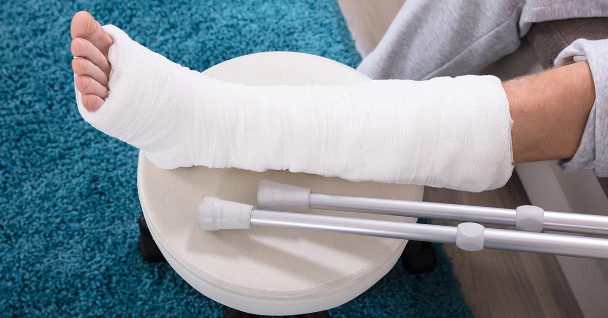 Physiotherapy rehabilitation following bone fracture injury recovery
