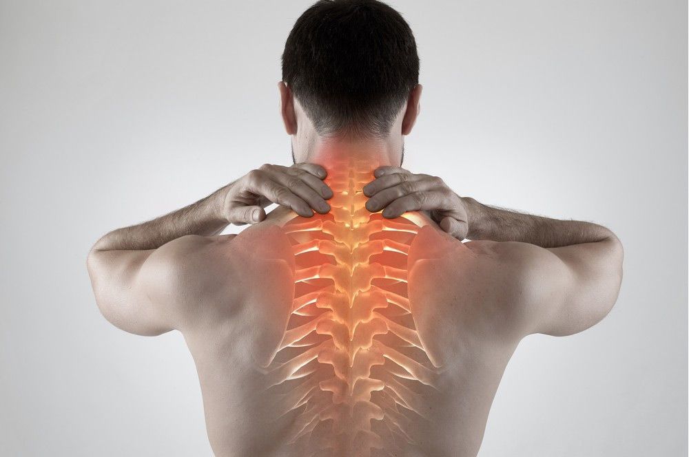 Herniated disc causing back pain and nerve compression treated with physiotherapy