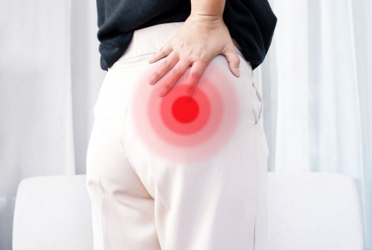 Piriformis syndrome causing lower back and hip pain treated with physiotherapy