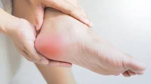 Plantar fasciitis heel pain treated with physiotherapy and shockwave therapy
