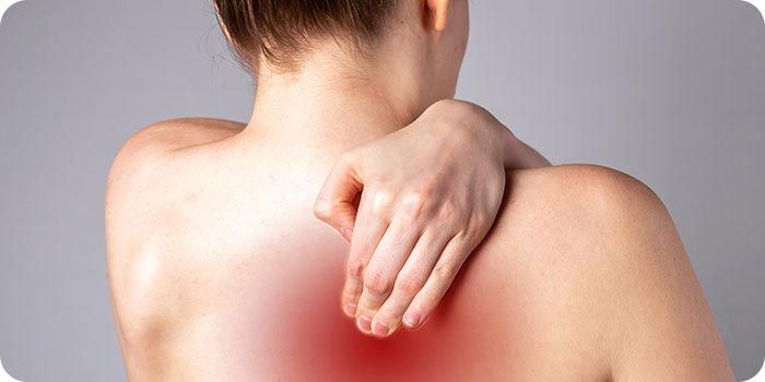 Radiculopathy causing neck and upper back nerve pain treated with physiotherapy at Dynamic Physiotherapy Mississauga